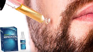 ¿A QUE EDAD USAR MINOXIDIL PARA TENER BARBA  JM Montaño [upl. by Dubois480]