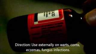 Salicylic Acid for fungal infection on my elbow [upl. by Aicenav265]