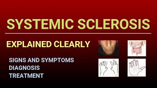 Systemic Sclerosis [upl. by Chapman]