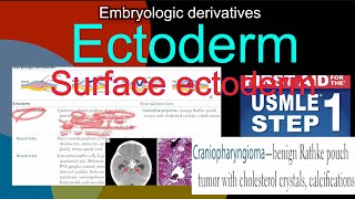 Embryologic derivatives  Ectoderm Surface ectoderm Craniopharyngioma in HindiUrdu by first aid [upl. by Aeslek]