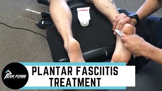 Plantar Fasciitis Treatment San Diego Graston Chiropractic [upl. by Hcirdla66]