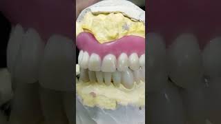 Zirconia Bridge vs Acrylic Denture dentalartbyhaider [upl. by Lhok]