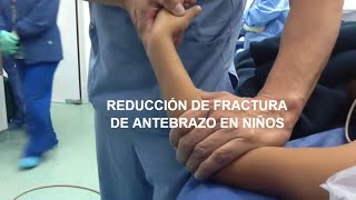 FRACTURA DE ANTEBRAZO EN EL NIÑO TRATAMIENTO QUIRURGICO [upl. by Arres]