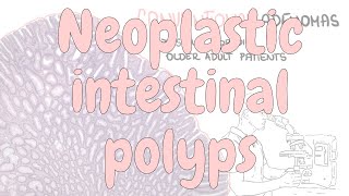 Neoplastic intestinal polyps  digestive system pathology [upl. by Kornher515]