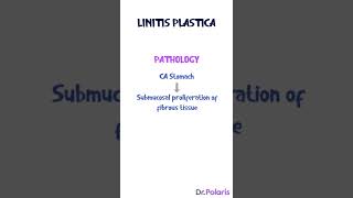 Linitis Plastica  General Surgery [upl. by Annaear]