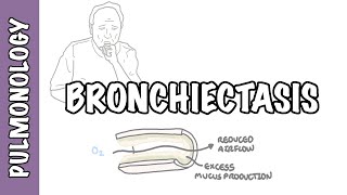 Bronchiectasis  causes pathophysiology signs and symptoms investigations and treatment [upl. by Clymer]