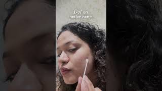 Overnight Acne Spot Corrector  How to Use [upl. by Vallo]