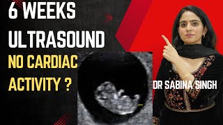 Why Heart Beat Never Comes In Early Pregnancy  6 weeks of pregnancy and ultrasound [upl. by Eenitsed]