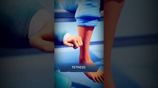 Why Tetanus is Worse Than You Think TetanusDisease viralvideo [upl. by Bodkin400]