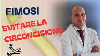 NO ALLA CIRCONCISIONE Esistono delle alterantive all intervento chirurgico [upl. by Gillan]