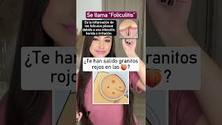 Foliculitis 👩🏻‍⚕️ sabíasque interesante foliculitis medicina [upl. by Vine]