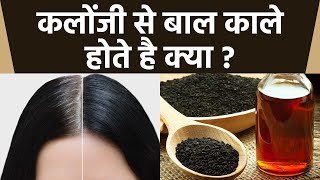 कलोंजी से बाल काले होते है क्या  Kalonji Se Safed Balo Ko Kala Kaise Karen  Boldsky health [upl. by Aniri949]