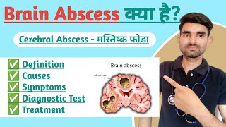 Brain Abscess Lecture in Hindi  Causes Symptoms And Treatment of Brain Abscess [upl. by Kcirddec]