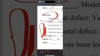 Case sheet Periodontics 5th stage part2 [upl. by Meadow823]