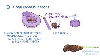 collection of stool specimen  Nursing  Osmosis [upl. by Subir313]