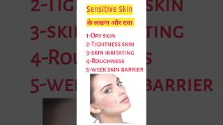 sensitive skin के लक्षण और उपचार।। episoft moisturizer lotion [upl. by Palla]