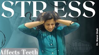 Clenching Grinding Teeth in Stress  Effects of Stress on Teeth [upl. by Euqinomad602]