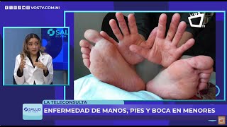 Cuidado con la enfermedad viral contagiosa de manos pies y boca en niños [upl. by Eiddam380]