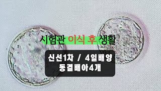 시험관 브이로그 시험관 이식 당일 신선1차 4일배양  동결배아 갯수  무증상이라 더 이상해😜 [upl. by Dexter]