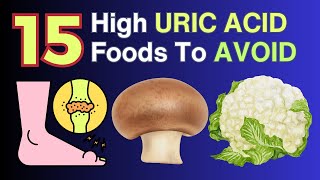 15 High Uric Acid Foods To Avoid For Gout  VisitJoy [upl. by Heady]