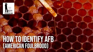 How to Identify AFB American Foulbrood  The Bush Bee Man [upl. by Winfield]