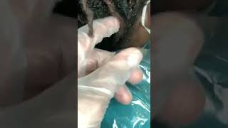 can you repair locs thinning at the roots [upl. by Eremaj]