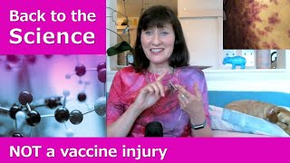 Horrendous vaccine injury LIES [upl. by Oiramed]