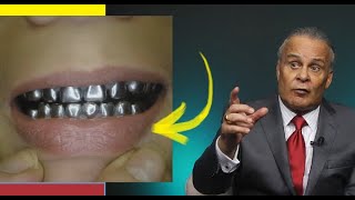 É isso que pode acontecer quando você tira um dente  Dr Lair Ribeiro [upl. by Mathia118]