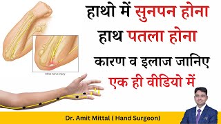 क्यों रहता हैं उंगलियों में सुनपन और हाथ का पतला होना। कारण व इलाज  Nerve Disorders [upl. by Gentes53]