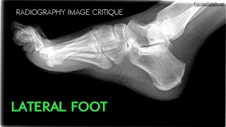 Topics in Radiography [upl. by Yhtommit]