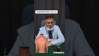 Chicken pox symptoms shorts unfreeze youtubeshorts viralshorts chicken chickenpox medicine [upl. by Rikki]