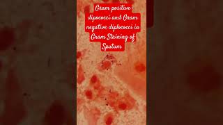 Gram positive dipococci and Gram Negative diplococci bacteria in Gram Staining of Sputum [upl. by Erdnaid]