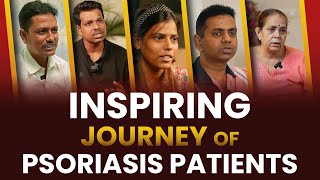 Inspiring Journey of Psoriasis Patients  Psoriasis Skin Disease  Dr Megha Chaturvedi [upl. by Ardnuaet]