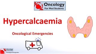 Hypercalcaemia of malignancy [upl. by Anitram]