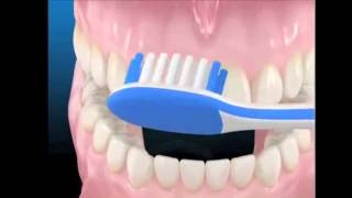 Effective Tooth Brushing Methods [upl. by Eenwat]