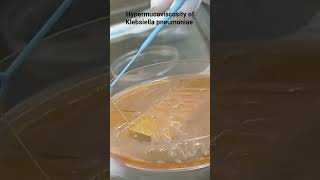 ➡️ Hypermucoviscosity of Klebsiella Pneumoniae microbiology [upl. by Francesco619]