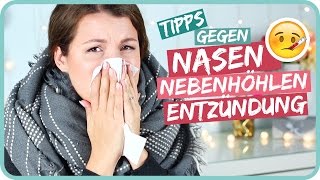 Tipps gegen Nasennebenhöhlenentzündung – SINUSITIS TypischSissi [upl. by Shulman]