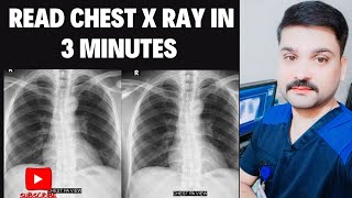 How To Read A Chest Xray in Urdu [upl. by Johnathon]