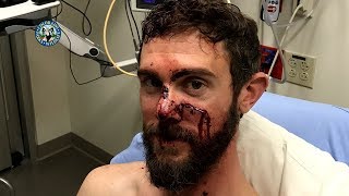 Colorado Man Travis Kauffman Survives Mountain Lion Attack [upl. by Winchell]