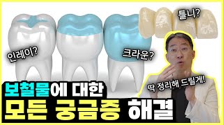 보철물 아래로 치아가 드러났다고 보철물이 망가졌다고 [upl. by Inait]