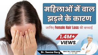 How To Treat Female Hair Loss  बाल झड़ना कैसे रोके  Female Pattern Hair Loss  Causes amp Treatment [upl. by Somisareg186]