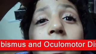 Chronic Progressive External Ophthalmoplegia  شلل عضلات العين [upl. by Anelegna]