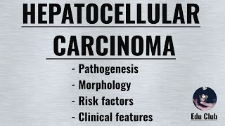 Hepatocellular Carcinoma  HCC   Pathophysiology  Morphology  Clinical features [upl. by Oirrad944]