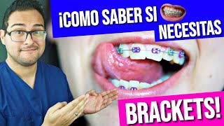 ¡COMO saber si necesito BRACKETS 👅 GUÍA PRACTICA 2019 😎 ORTODONCIA [upl. by Malarkey528]