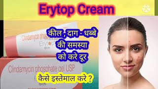 Erytop Cream review in hindi  Uses  कील दाग और धब्बे की समस्या को करे दुर [upl. by Marnie]