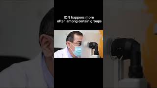 What are the risk factors for ischemic optic neuropathy ION [upl. by Olonam981]