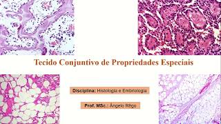 Aula Histologia tecido conjuntivo de propriedades especiais Parte II [upl. by Garrek]