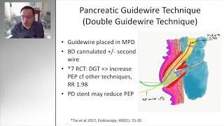 ERCP TIPS AND TRICKS DIFFICULT BILIARY CANNULATION [upl. by Retluoc]