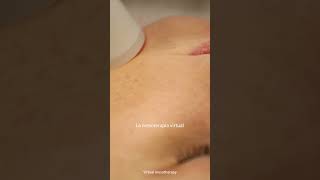 Mesoterapia inyectada 🆚 Mesoterapia virtual beauty piel tratamientoestetico cuidadopiel [upl. by Drona432]