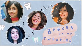 Braces in Your Twenties  Story Time  Vitasta Bhat [upl. by Nosde973]